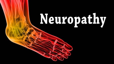 neuropathy