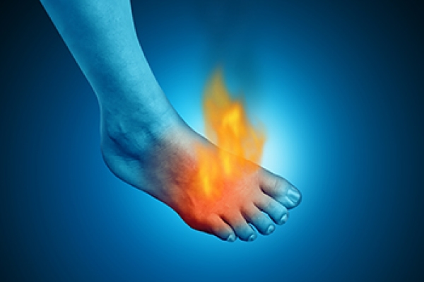 Achilles Tendinitis Burning Pain In My Heel HOT Achilles